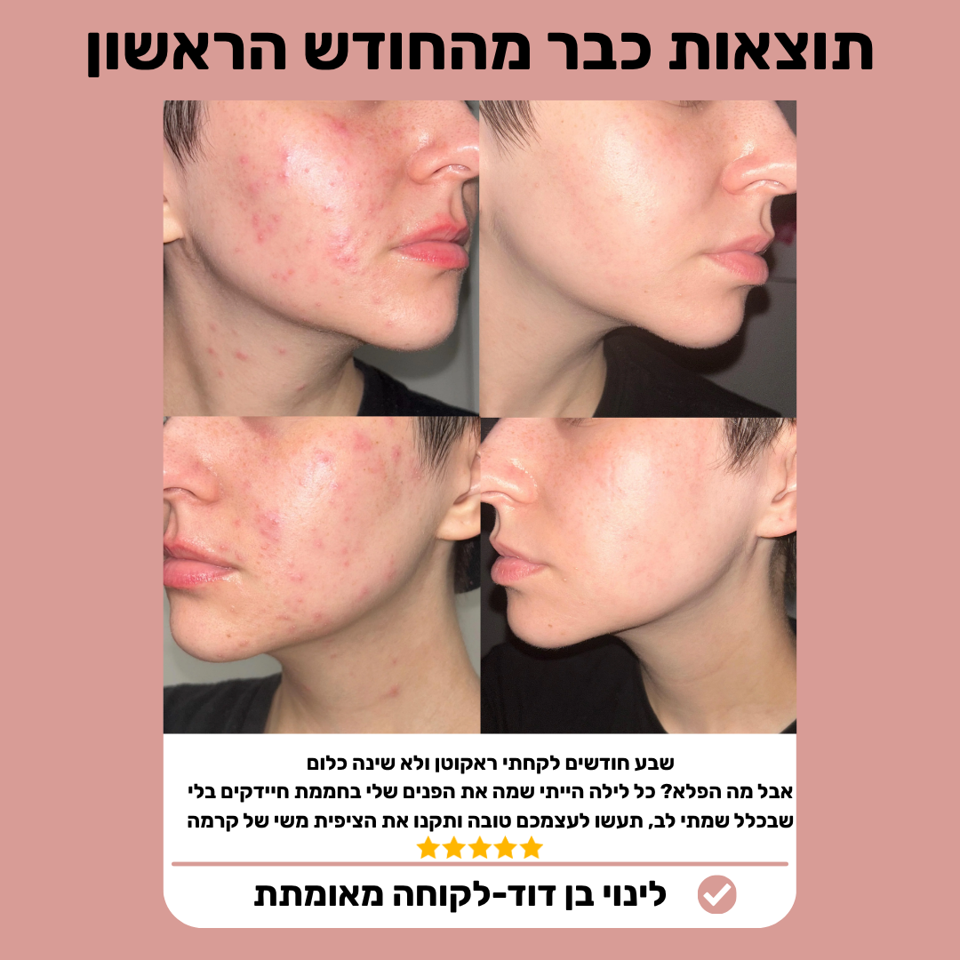 crema-ציפית משי פרימיום