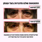 GLOW-מכשיר לעיסוי וטיפוח אזור העיניים למראה רענן וזוהר יותר