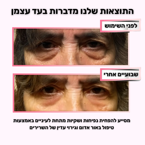 GLOW-מכשיר לעיסוי וטיפוח אזור העיניים למראה רענן וזוהר יותר