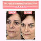GLOW-מכשיר לעיסוי וטיפוח אזור העיניים למראה רענן וזוהר יותר